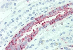 Invitrogen SLC4A2 Polyclonal Antibody 50 &mu;g; Unconjugated:Antibodies,
