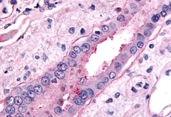 Invitrogen SGLT2 Polyclonal Antibody 50 &mu;g; Unconjugated:Antibodies,