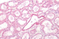 SSTR2 Polyclonal Antibody 50 &mu;g | Buy Online | Thermo Scientific | Fisher Scientific