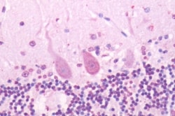 SSTR2 Polyclonal Antibody 50 &mu;g | Buy Online | Thermo Scientific | Fisher Scientific