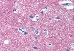 Invitrogen Syntaxin 1 Polyclonal Antibody 50 &mu;g; Unconjugated:Antibodies,