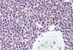 Invitrogen SYNGR2 Polyclonal Antibody 50 &mu;g; Unconjugated:Antibodies,