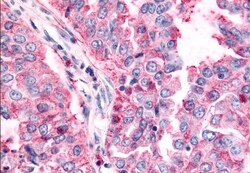 Invitrogen TAOK1 Polyclonal Antibody 50 &mu;g; Unconjugated:Antibodies,