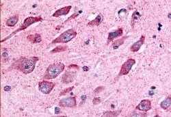 Invitrogen TAOK1 Polyclonal Antibody 50 &mu;g; Unconjugated:Antibodies,