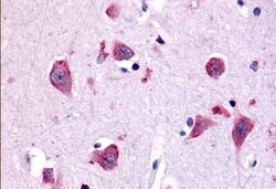 Invitrogen TAOK1 Polyclonal Antibody 50 &mu;g; Unconjugated:Antibodies,