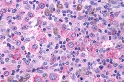 TBXA2R Polyclonal Antibody:Antibodies, Polyclonal