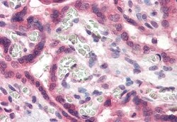Invitrogen TFF2 Polyclonal Antibody 50 &mu;g; Unconjugated:Antibodies,