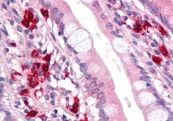Invitrogen TFF2 Polyclonal Antibody 50 &mu;g; Unconjugated:Antibodies,
