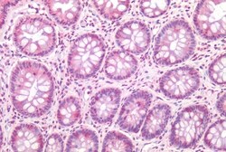 Invitrogen TM9SF4 Polyclonal Antibody 50 &mu;g; Unconjugated:Anticuerpos