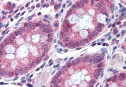 Invitrogen TMPRSS4 Polyclonal Antibody 50 &mu;g | Buy Online | Invitrogen&trade; | Fisher Scientific