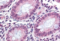 Invitrogen TMPRSS4 Polyclonal Antibody 50 &mu;g; Unconjugated:Antibodies,