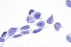 TPRA1 Polyclonal Antibody, Invitrogen 50 &mu;g; Unconjugated:Antibodies,