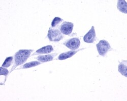 TPRA1 Polyclonal Antibody, Invitrogen 50 &mu;g; Unconjugated:Antibodies,