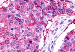 TPRA1 Polyclonal Antibody, Invitrogen 50 &mu;g; Unconjugated:Antibodies,