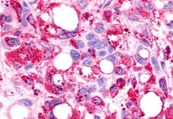 TPRA1 Polyclonal Antibody, Invitrogen 50 &mu;g; Unconjugated:Antibodies,