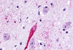 TPRA1 Polyclonal Antibody, Invitrogen 50 &mu;g; Unconjugated:Antibodies,