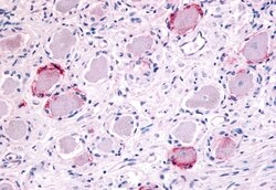 Invitrogen TRPA1 Polyclonal Antibody 50 &mu;g; Unconjugated:Antibodies,