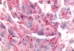 Invitrogen TRPA1 Polyclonal Antibody 50 &mu;g; Unconjugated:Antibodies,