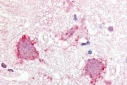 Invitrogen TRPA1 Polyclonal Antibody 50 &mu;g; Unconjugated:Antibodies,