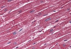 Invitrogen TRPM4 Polyclonal Antibody 50 &mu;g; Unconjugated:Antibodies,