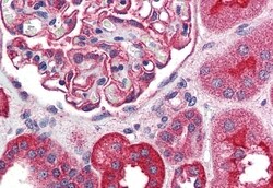 Invitrogen TRPM4 Polyclonal Antibody 50 &mu;g; Unconjugated:Antibodies,