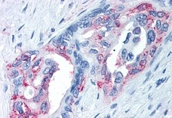 Invitrogen TRPM8 Polyclonal Antibody 50 &mu;g; Unconjugated:Antibodies,
