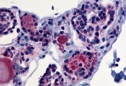 Invitrogen TSH Receptor Polyclonal Antibody 50 &mu;g | Buy Online | Invitrogen&trade; | Fisher Scientific