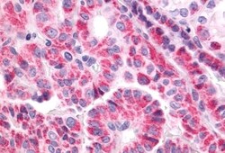 Invitrogen TSH Receptor Polyclonal Antibody 50 &mu;g | Buy Online | Invitrogen&trade; | Fisher Scientific