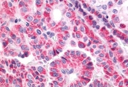 Invitrogen TSH Receptor Polyclonal Antibody 50 &mu;g | Buy Online | Invitrogen&trade; | Fisher Scientific