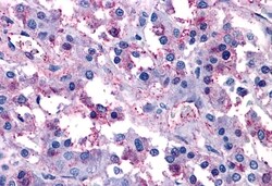 Invitrogen VIPR1 Polyclonal Antibody 50 μg; Unconjugated:Antibodies,