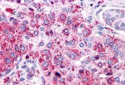 Invitrogen VIPR1 Polyclonal Antibody 50 μg; Unconjugated:Antibodies,