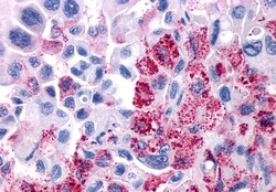 Invitrogen VIPR1 Polyclonal Antibody 50 μg; Unconjugated:Antibodies,