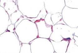Invitrogen VIPR1 Polyclonal Antibody 50 μg; Unconjugated:Antibodies,