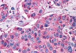 Invitrogen VIPR1 Polyclonal Antibody 50 μg; Unconjugated:Antibodies,