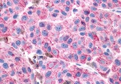 Invitrogen VIPR1 Polyclonal Antibody 50 μg; Unconjugated:Antibodies,