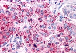 Invitrogen VIPR1 Polyclonal Antibody 50 μg; Unconjugated:Antibodies,