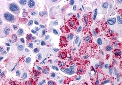 Invitrogen VIPR1 Polyclonal Antibody 50 μg; Unconjugated:Antibodies,