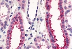 VN1R1 Polyclonal Antibody:Antibodies, Polyclonal