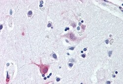 Invitrogen WNT8B Polyclonal Antibody 50 μg; Unconjugated:Antibodies,
