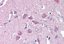 Invitrogen WNT9A Polyclonal Antibody 50 μg; Unconjugated:Antibodies,