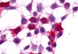 Invitrogen XPR1 Polyclonal Antibody 50 μg; Unconjugated:Antibodies,