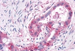 Invitrogen XPR1 Polyclonal Antibody 50 μg; Unconjugated:Antibodies,