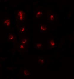 Invitrogen TSHZ1 Polyclonal Antibody 100 &mu;g; Unconjugated:Antibodies,