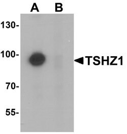 Invitrogen TSHZ1 Polyclonal Antibody 100 &mu;g; Unconjugated:Antibodies,