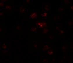 Invitrogen TSHZ2 Polyclonal Antibody 100 &mu;g; Unconjugated:Antibodies,