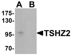 Invitrogen TSHZ2 Polyclonal Antibody 100 &mu;g; Unconjugated:Antibodies,