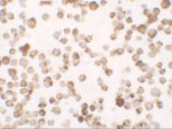 RNASET2 Polyclonal Antibody:Antibodies, Polyclonal