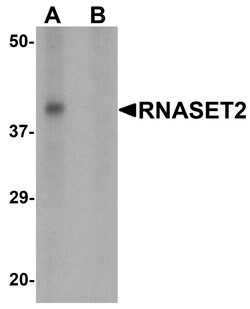 RNASET2 Polyclonal Antibody:Antibodies, Polyclonal