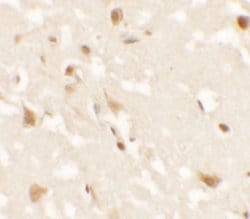 Invitrogen AIG1 Polyclonal Antibody 100 &mu;g; Unconjugated:Antibodies,