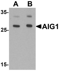 Invitrogen AIG1 Polyclonal Antibody 100 &mu;g; Unconjugated:Antibodies,